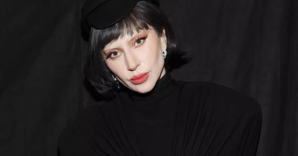 «Схудла й постаріла»: Леді Гага запідозрили в уколах для боротьби з апетитом